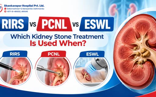 RIRS vs PCNL vs ESWL: Which Kidney Stone Treatment Is Used When?